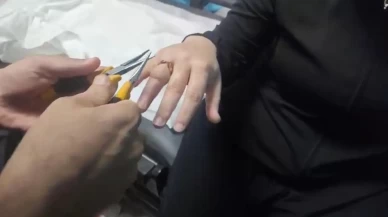 Kadının parmağına sıkışan yüzük, itfaiye ekibince hastanede çıkarıldı
