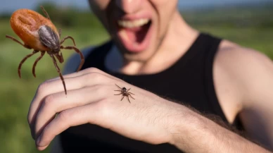 Kene ısırmalarında yeni tedavi yöntemi!