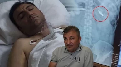 15 Temmuz gazisi vücudundaki kurşunla yaşıyor