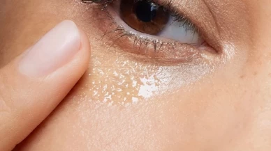 Göz altı morluklarını hemen geçiren tarif!