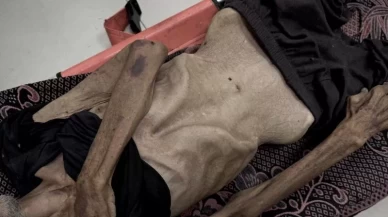 Gazze’de açlık can almaya devam ediyor!