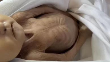 İsrail'in aç bırakma politikası can almaya devam ediyor