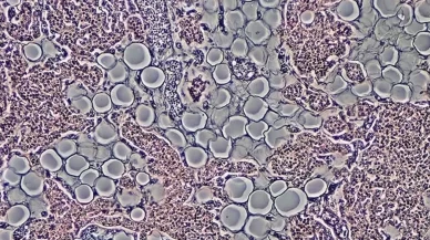 Laboratuvarda ilk canlı insan derisi geliştirildi