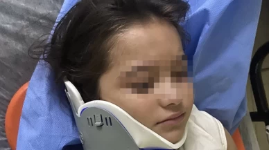 Ordu'da ters şeritten gelen scooter, 8 yaşındaki çocuğa çarptı