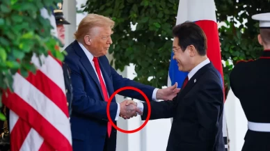 Donald Trump'ın elindeki morluk dikkat çekti!