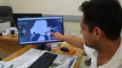 Aylarca kanser sandılar, gerçek bambaşka çıktı!