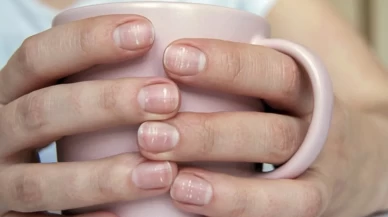 Tırnaklardaki beyaz çizgilerin sebebi ne?
