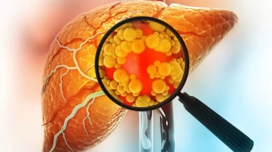 Doktorların dikkatini çeken kür