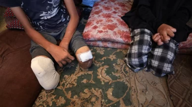 7 Ekim'den bu yana Gazze'de 4 bin çocuk ampute edildi