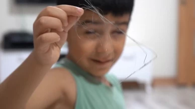 Salatalık yutunca hastaneye gitti: Vücudunda 3 yıl önce unutulan 18 santimlik kateter çıktı