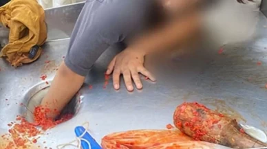 Şanlıurfa’da feci olay! Salça makinesine elini kaptırmıştı