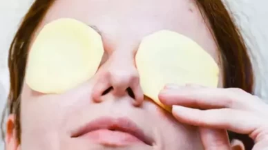 Göze patates koymanın faydaları