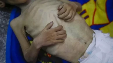 Gazze'de açlıktan ölüyor!