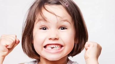 Her 10 çocuktan 6’sının dişi çürük: Uzmanlar eğitim hayatına etkisine dikkat çekiyor