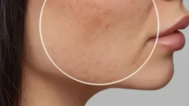 Gözenekler bir anda açılıyor! Bu maske sosyal medyayı salladı