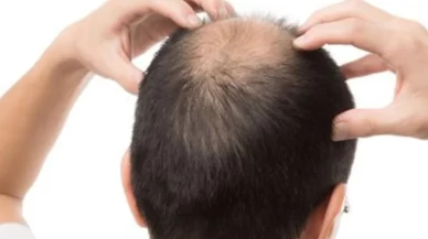 Pilav saç dökülmesini tetikliyor