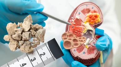 Saraçoğlu’ndan doğal kür önerisi