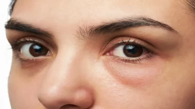 Hızlı çözüm arayanlar buraya