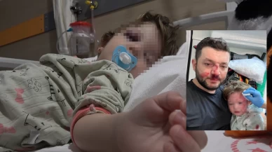 Yalova Esenköy'de 14 aylık bebek ve babasına saldırıya bakanlık el koydu! Akın Gürlek'ten flaş açıklama