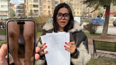 Eskişehir’de kreş skandalı iddiası! 2 yaşındaki Atlas’ın vücudundaki morluklar nereden geldi?