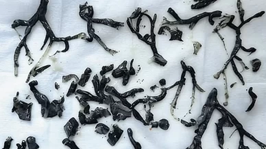 Nefes darlığıyla hastaneye gitti