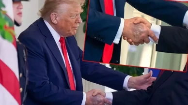 Vücudundaki morluklar gündemdeydi! Trump'tan hastane kararı