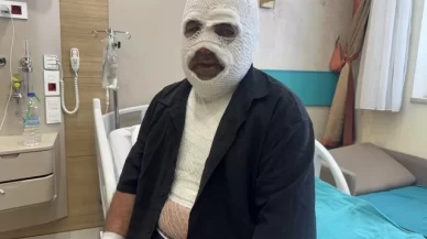 Sürücüleri 'Ben yandım başkası yanmasın' diyerek uyardı!