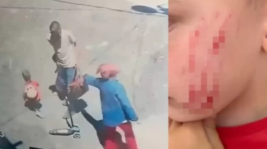 Sokakta oynayan 4 yaşındaki çocuğa çirkin saldırı!