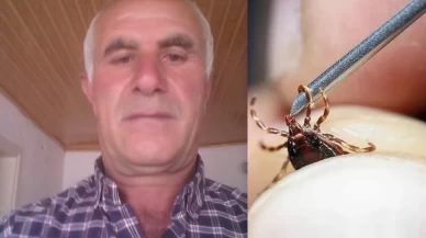 Keneyi çıkardı, 4 gün sonra öldü