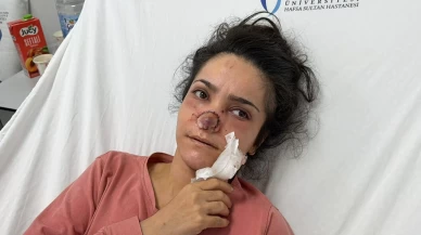 Manisa’da eşinin saldırısında burnu kopan kadına ameliyat