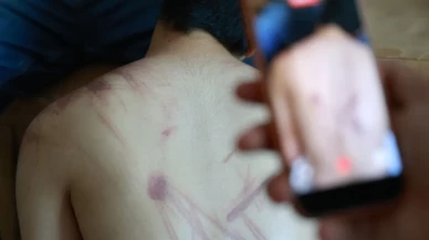 Rehabilitasyon merkezinde şiddet! Olayla ilgili soruşturma başlatıldı
