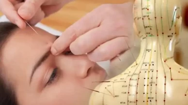 Akupunkturun bilinmeyen faydaları ortaya çıktı