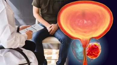Prostat kanserinde erken tanı için uzmanlardan uyarı