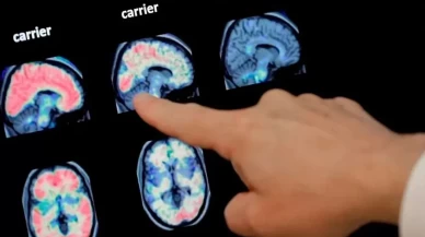 Alzheimer'ın sırrı derin uykuda mı?