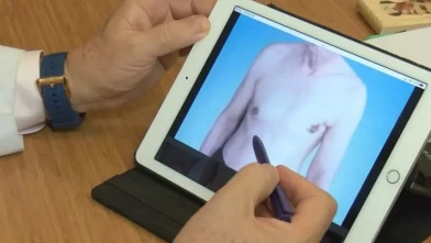 Meme kanseri belirtisi olabilir