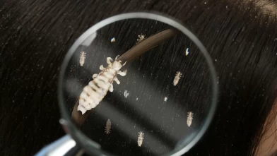 Rüyada bit görmek ne anlama gelir? Bit öldürmek, temizlemek ve ısırılmak ne demektir?