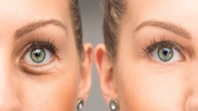 İşte o konuşulan yutkunma tekniği