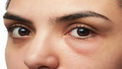 Hızlı çözüm arayanlar buraya