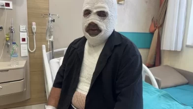 Sürücüleri 'Ben yandım başkası yanmasın' diyerek uyardı!