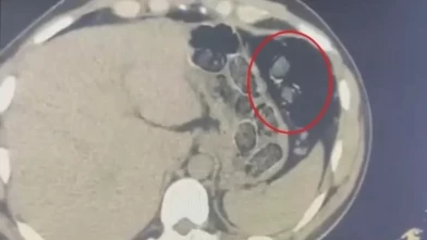 Diyarbakır'da midelerinde 1 kiloya yakın metamfetamin taşıyan 2 şüpheli tutuklandı