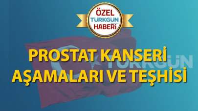 Prostat kanseri aşamaları ve teşhisi