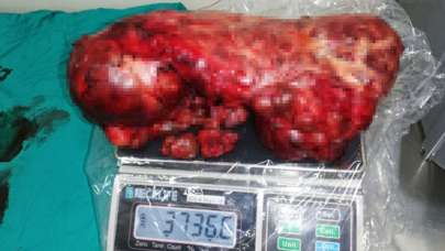 Ağrı şikayetiyle gitti, karnındaki şoke etti! '