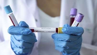 Umut veren rapor! Türkiye de listede