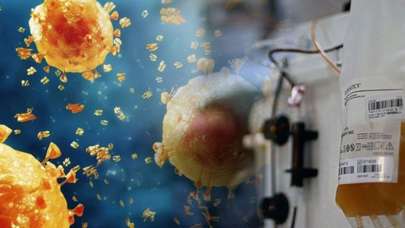 Plazma tedavisi gördükten sonra hayatını kaybetti