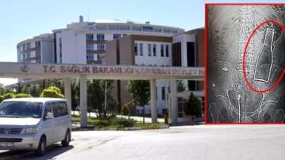 Bağırsağından şişe çıkan gençten açıklama