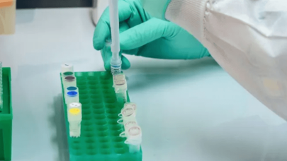 Avrupa ilaç kurumu açıkladı: Aşı onayı yıl sonu verilebilir