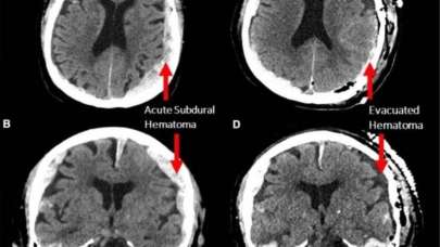 Ölen insanın beyni ilk kez görüntülendi