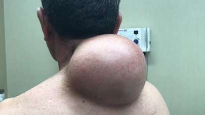 Boynundan çıkan şey şoke etti