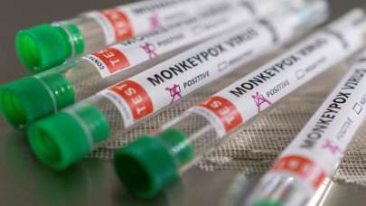 KKTC'de maymun çiçeği virüsüne rastlanmadı