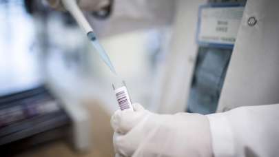 DSÖ’den maymun çiçeği salgını ile ilgili uyarı